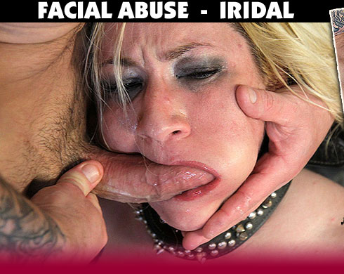 Facial Abuse Destroys Iridal